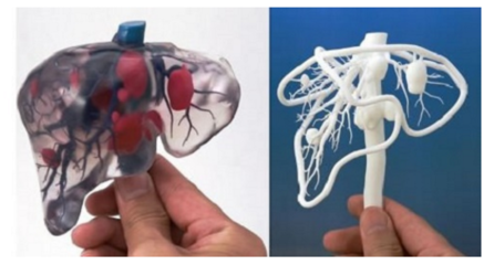 创想三维引领突破 医学3D打印发现“仿生胰腺”革新疗法